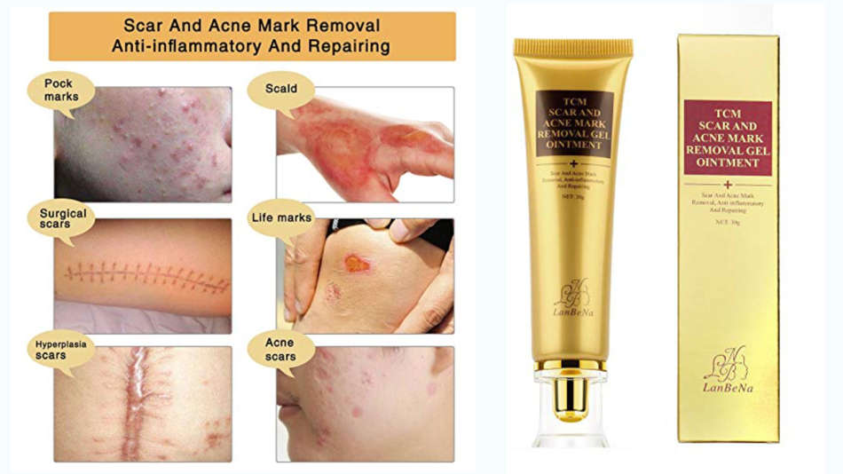 TCM skin scar & acne marks removal gel oitment.30g. anti-inflamatory repair .