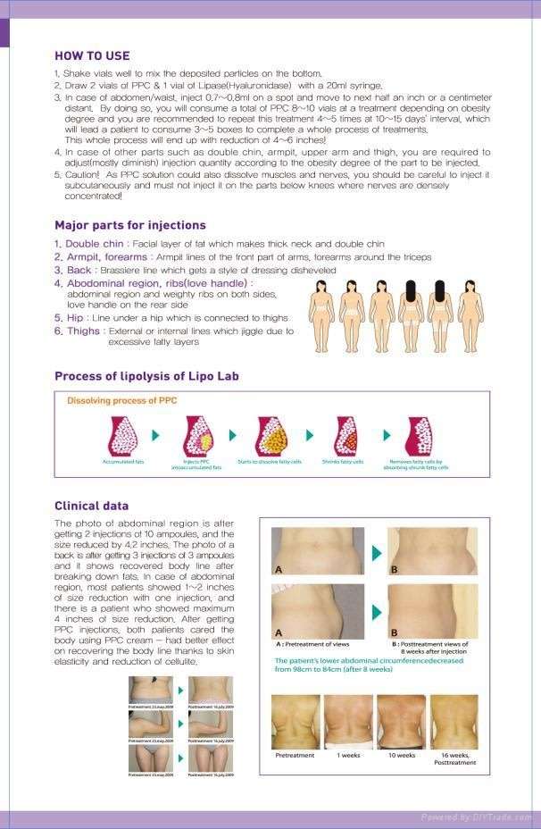 1000mg Insane Winter Special PPC LipoLab Slim1vial=20injection Weight loss.skin thigtening-lifting