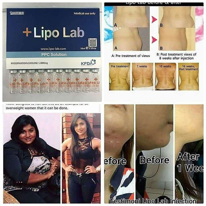 #1 Insane  Special PPC LipoLab Slim1vial=20injection Weight loss.skin tightening and lifting
