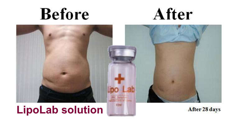 #1 Insane  Special PPC LipoLab Slim1vial=20injection Weight loss.skin tightening and lifting