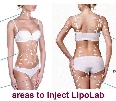 #1 Insane  Special PPC LipoLab Slim1vial=20injection Weight loss.skin tightening and lifting