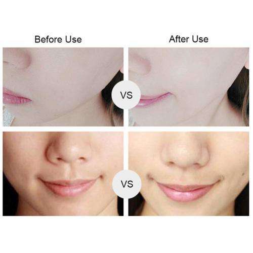 5 in 1 Electric Face Cleansing Brush Tools Spot Cleaner Facial Clean Instrument