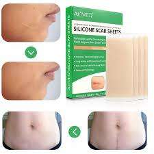 Silicone scar sheets