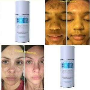 Ultra-Potent Skin Lightening Serum (Admire my Skin) 30 ml For Hyperpigmentation, Melasma, Dark Spots