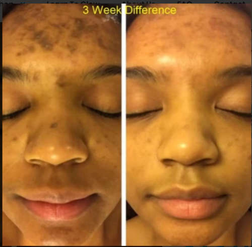 Ultra-Potent Skin Lightening Serum (Admire my Skin) 30 ml For Hyperpigmentation, Melasma, Dark Spots