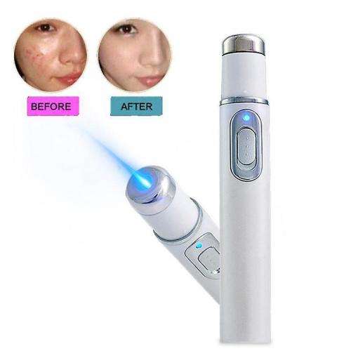 Blue Light Therapy Acne Laser Pen