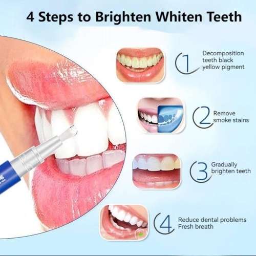 Teeth Whitening Pen
