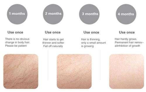 2019 Professional Permanent IPL Epilator - 600,000 flashes