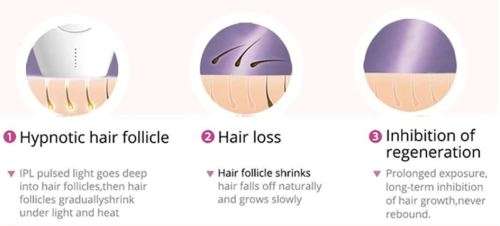 2019 Professional Permanent IPL Epilator - 600,000 flashes