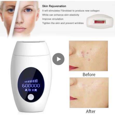 2019 Professional Permanent IPL Epilator - 600,000 flashes