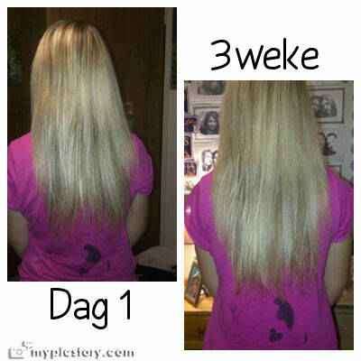 PEANIE HAIR GROWTH TONIC - shipping only R30-00 extra Get yours now!!!!
