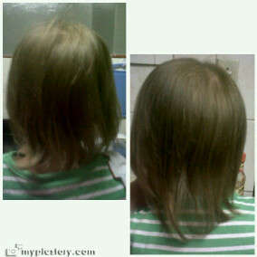PEANIE HAIR GROWTH TONIC - SAFE FOR TODDLERS - KIDS ALL AGES shipping R30-00 Get yours now!!!!