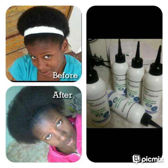 NEW PRODUCT !! - PEANIE "ETHNIC" HAIR GROWTH TONIC - item courier extra fee