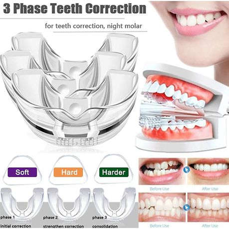 Teeth Grinding - 3 Stage Bruxism TMJ Plate