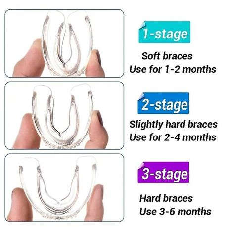Teeth Grinding - 3 Stage Bruxism TMJ Plate