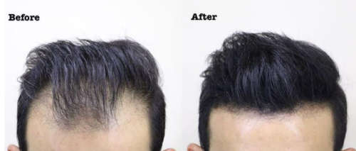 Thick Fiber Hair Building Fibers - Black (Travelsize - 12g)