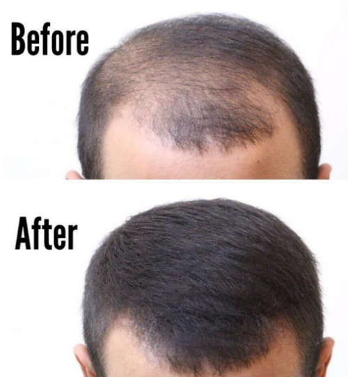 Thick Fiber Hair Building Fibers - Black (Travelsize - 12g)