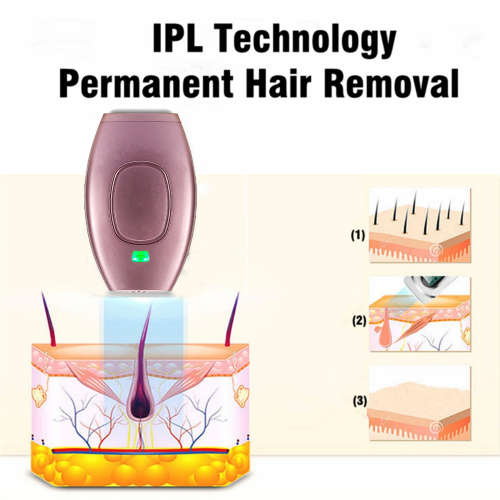 ILP Hair Removal Handset