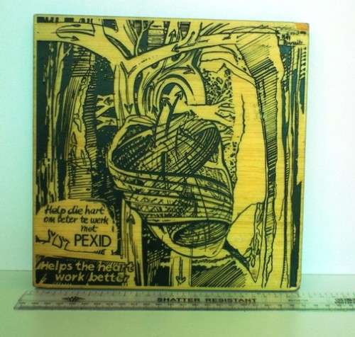 NILS BURWITZ RESIN ETCHING OF THE HUMAN HEART