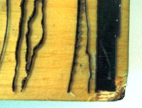 NILS BURWITZ RESIN ETCHING OF THE HUMAN HEART