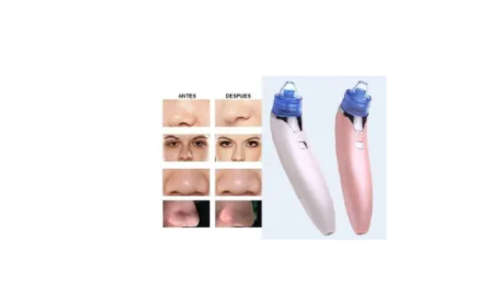 Electric Facial Pore Cleanser Blackhead Remover Vacuum Suction Machine