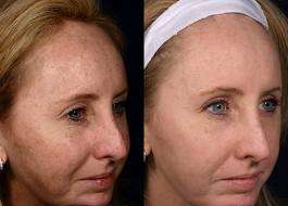 REVIVE SKIN REPAIR - YOUR SECRET WEAPON FOR YOUTHFUL SKIN!