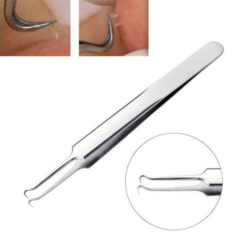 Blackhead Remover Tool Whitehead Pimple Acne Blemish Comedone Extractor