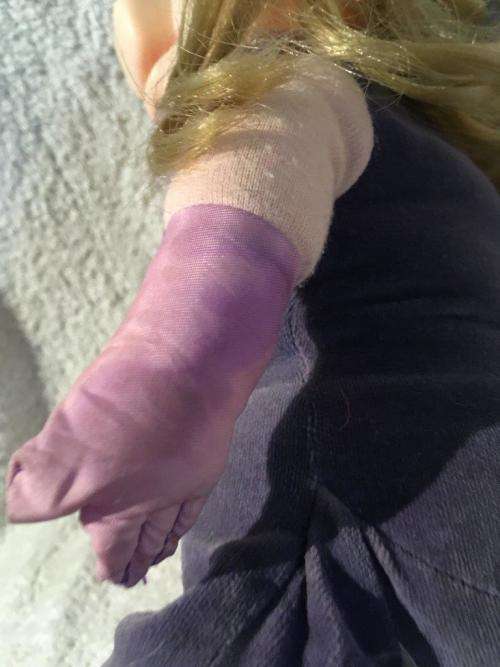 Vintage Miss Piggy - Henson Associates Inc 1981 +-34cm