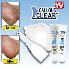 Callous Clear - Removes Calluses in Minutes