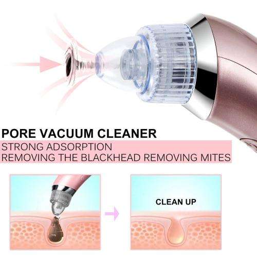 ELECTRIC BLACKHEAD REMOVER....WORKS LIKE A PRO!