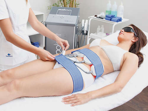 Eight laser lipo sessions