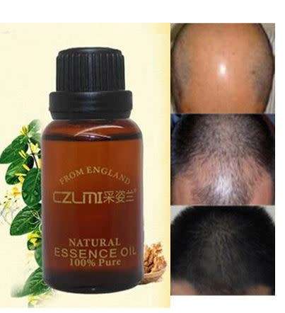 Andrea Keratin Hair Growth Essence  ( TRY THIS - IT REALLY WORKS)