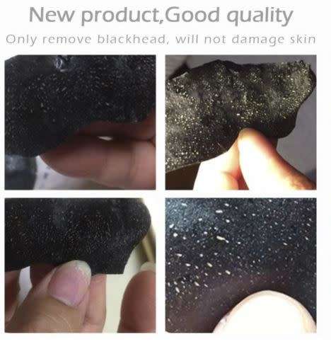 Blackhead Remover Nose Mask+Chin Forehead Black Head Mask Acne Treatment Pore Strip ( x 5 )