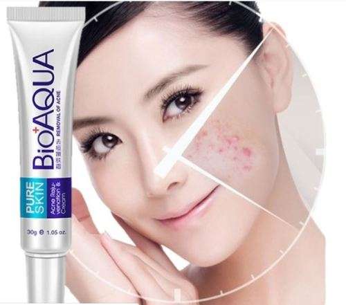 Face Anti Acne Scar Remove Cream