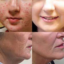 First Sun VITAMIN C SERUM - 10ML- excellent!!!