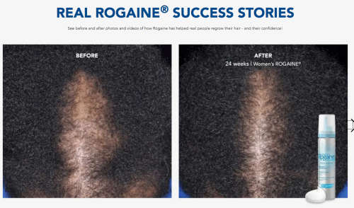 Rogaine x1 month