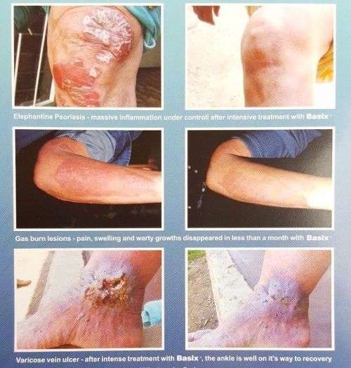 Basix Skin Repair Cream 4ml Sachet - FREE