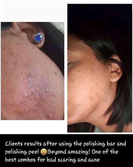 Nu Skin Epoch Polishing Bar