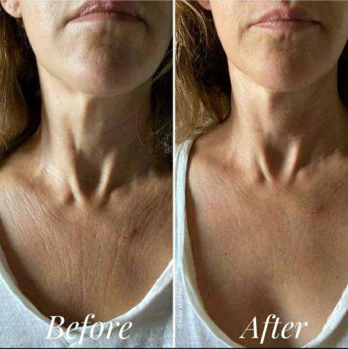 Nu Skin AgeLOC Dermatic Effects