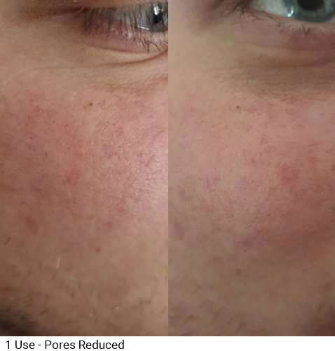 Nu Skin AHA Facial Peel and Neutraliser