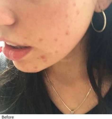 Nu Skin AHA Facial Peel and Neutraliser