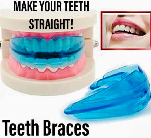 Teeth Aligner Braces DIY / 2 STAGES INCLUDED