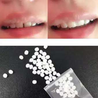 Tired of Teeth GAPS? Magic Tooth Repair Kits with FREE DELIVERY