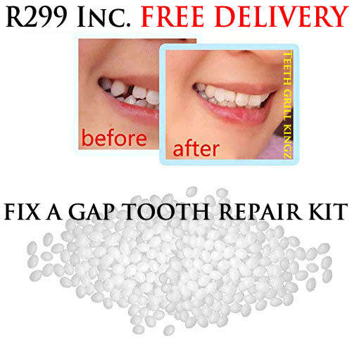 Tired of Teeth GAPS? Magic Tooth Repair Kits with FREE DELIVERY