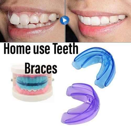 Teeth Straightening Braces DIY