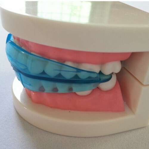 Braces Teeth Braces Straighten your Teeth Kids and Adults