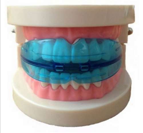 Braces Teeth Braces Straighten your Teeth Kids and Adults