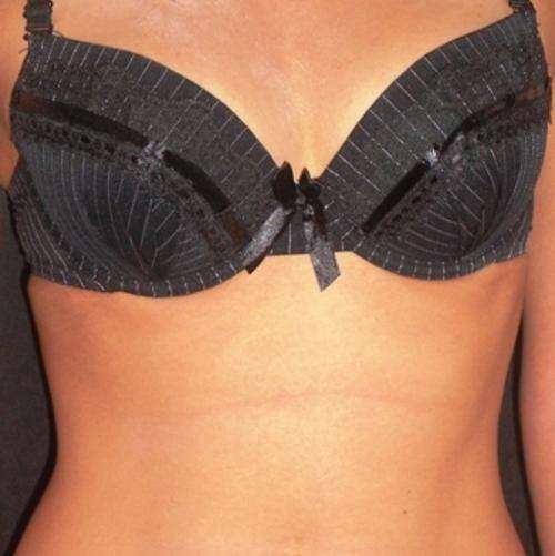 CLEARANCE SALE!!!! Sophisticated touch black pin striped Bra!!! 36B & 38B