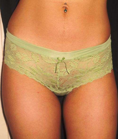 Beautiful full lace thong (green)