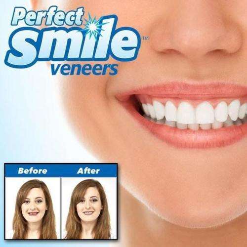 Perfect Smile Top Teeth Veneers